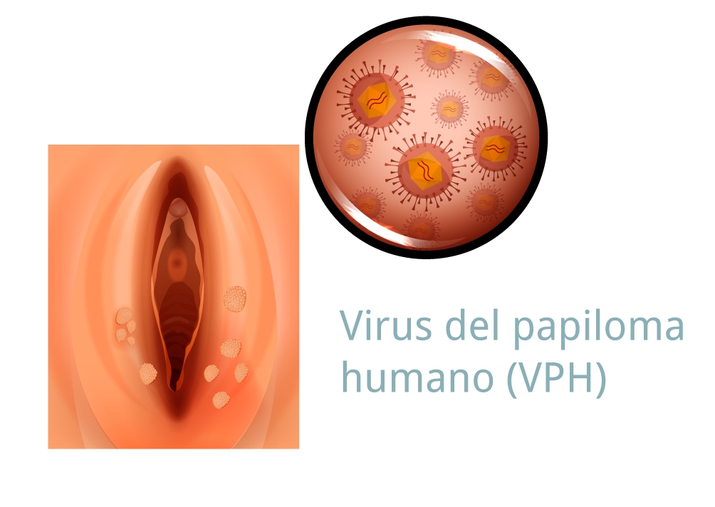 vph Medellín